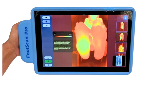 FootScan Pro clinical scanner