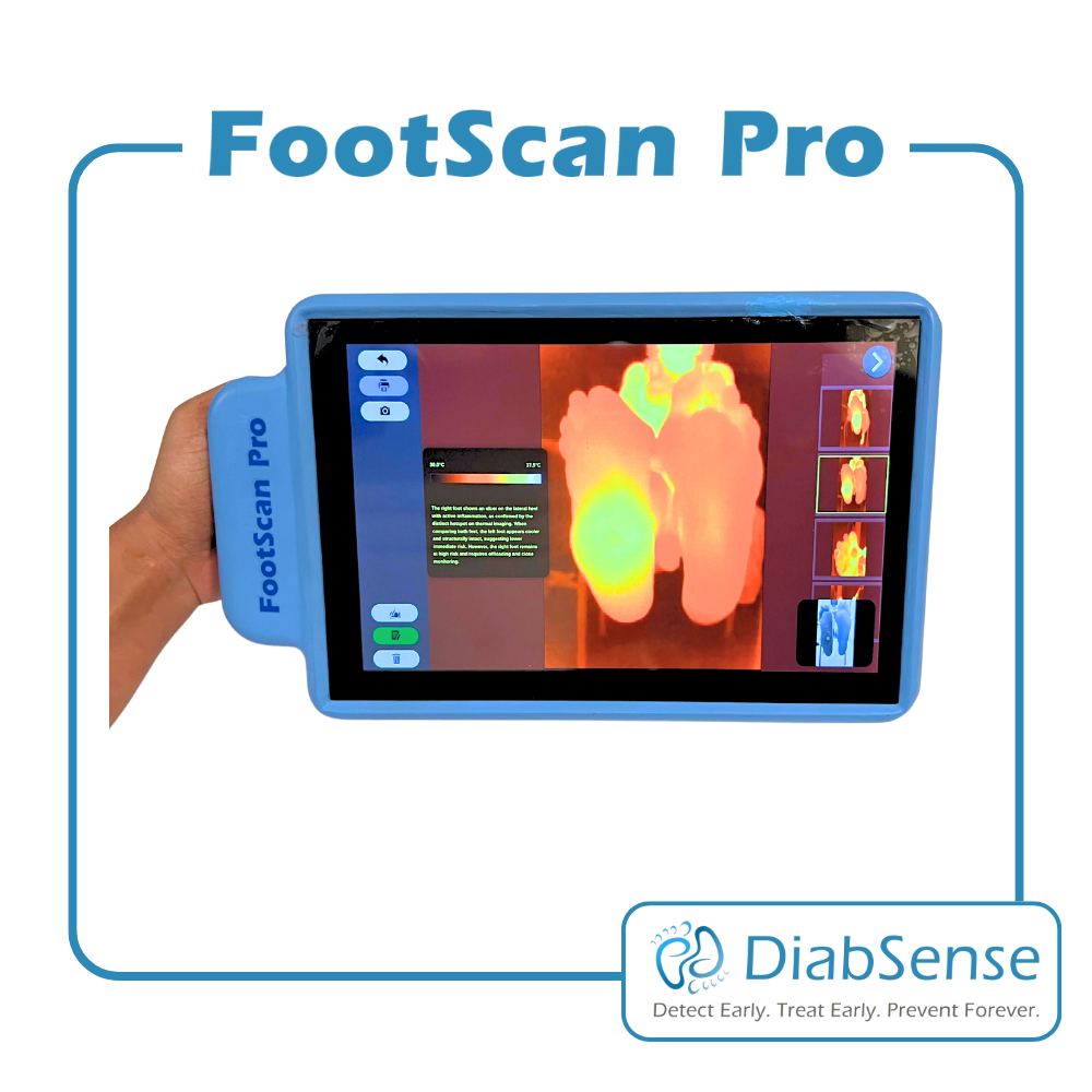 FootScan Slide 1